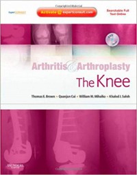 Image of Arthritis and arthroplasty The Knee