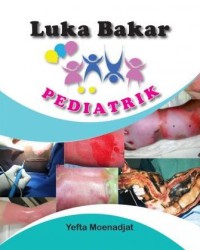 Image of Luka Bakar Pediatrik