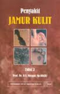 Image of Penyakit Jamur Kulit