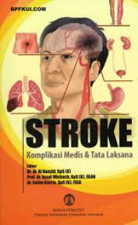 Image of Stroke Kompilasi Medis dan Tatalaksana