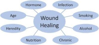 Image of Factors Affecting Wound Healing